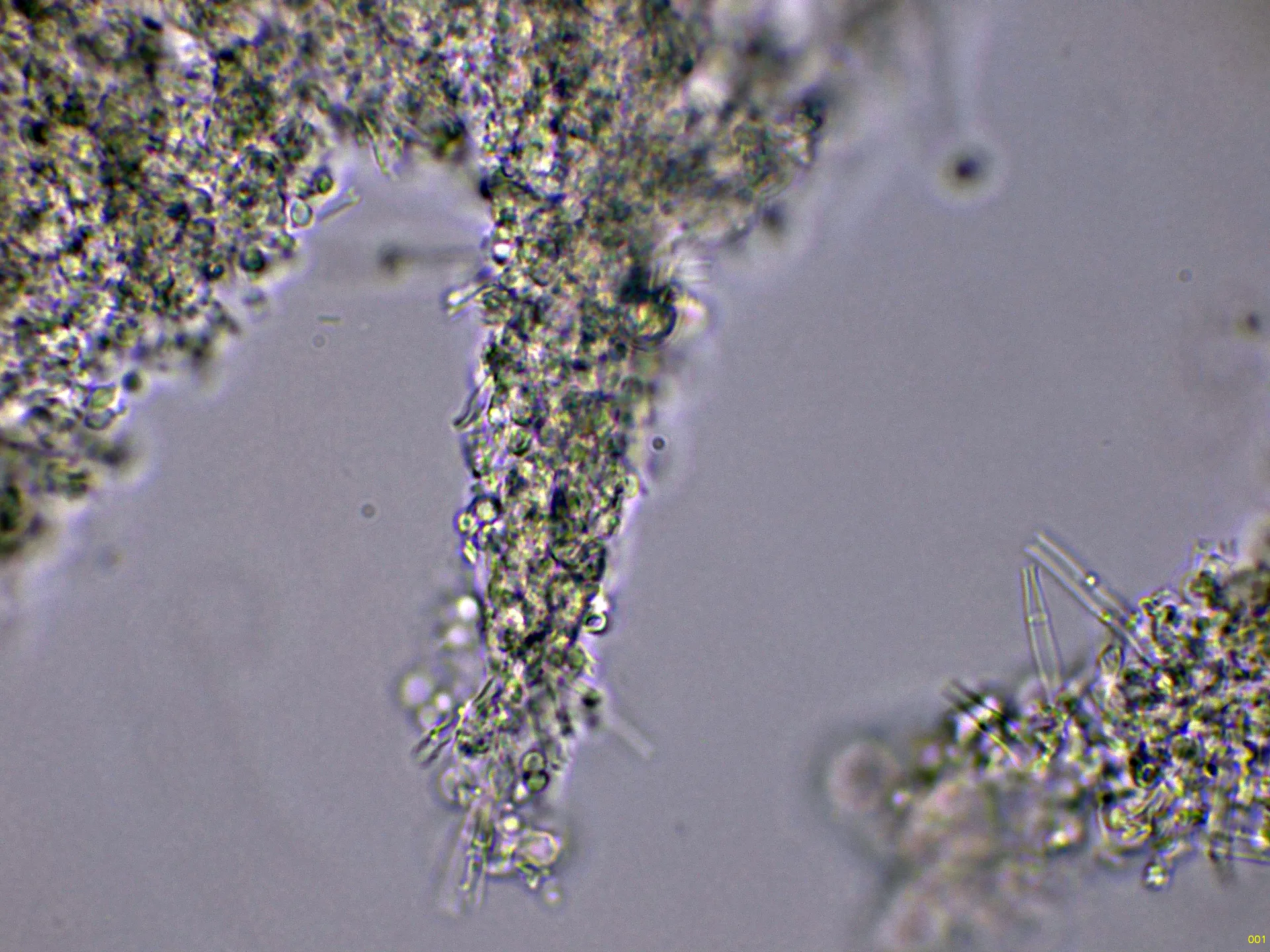 Microscopía de Ramaria paraconcolor - 10 - Rizomorfos agua-001